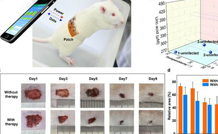 zhejiang researchers develop bandages that monitor recovery process